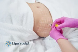 Are The Results From Aqualyx Permanent? 1 Do you want to know how long Aqualyx Sonning results last?