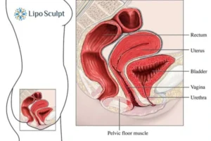 How EM Chair treatment Sonning can help Leaky bladder issues. Read more now!
