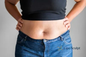 Bidding Farewell to Muffin Tops with Aqualyx Fat Injections 2 Do you wish you could reduce your muffin top Sonning With Aqualy fat dissolving injections you can!