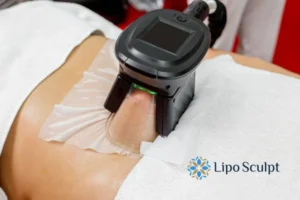 Does Fat Freezing At Home Work? 3 Fat freezing at home from Lipo Sculpt Sonning
